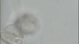 Vorticella (bell animalcule)