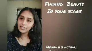 Finding Beauty In Your Scars