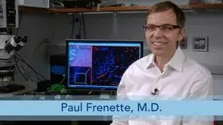 Science Talk: Nerves Play Key Role in Triggering Prostate Cancer and Influencing its Spread