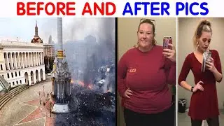 49 Of The Most Dramatic Before And After Pics