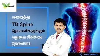 Does all TB Spine Patient Need Surgery? | Best Spine Surgeon |Dr. VIgnesh Pushparaj