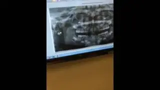 Addy Ortho  Clovis