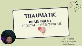 TBI Group Case Assignment