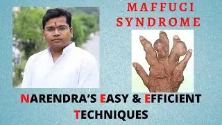 MAFFUCI SYNDROME/ NEETPG/ DNBCET/ INICET/ INEXT/ FMGE/ MBBS