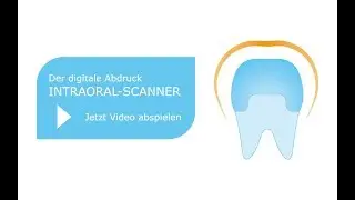 Intraoral-Scanner - Der digitale Abdruck
