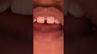 # btiga