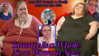 Unbelievable Transformation! Tammy Slaton's Journey Beyond Weight Loss | 1000-Lb Sisters Revealed!