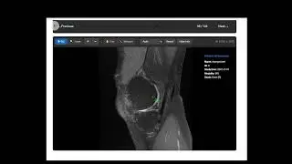 View yout TAC XRay CT Scan with Ippocra DICOM Viewer