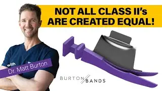 What are Burton Bands by Dr. Matt Burton