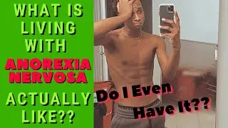 I was diagnosed with Anorexia Nervosa (Restricting Type) **TRIGGER WARNING** | Were they Correct?