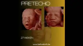 Pretecho Before Birth   27 weken