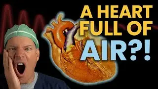 True Story - The Scariest Thing I Ever Saw In The OR!