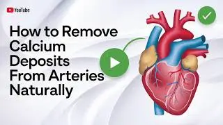 how to remove calcium deposits from arteries naturally
