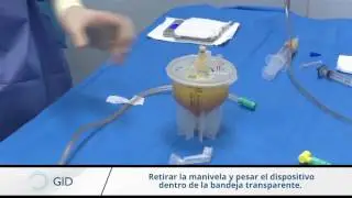 Video Procedimiento GID SVF 2