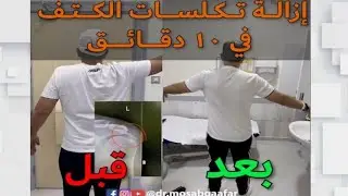 علاج وازالة التهاب و تكلسات الكتف في ١٠ دقائق