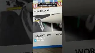 Jaw Pain? TMJ? This is what's happening in your jaw...#shorts
