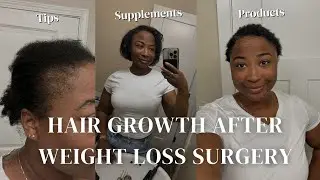 Hair Growth after Weight Loss Surgery | Tips, Supplements, and Products