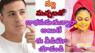 Nalla Machala Taggalante emi cheyali | Best Home Remedies for Dark Spots in Telugu | Gajaravana Hub