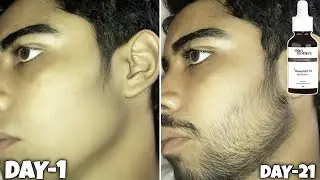 Man matters minoxidil review after use 21 days | man matters minoxidil review |man matters beard oil