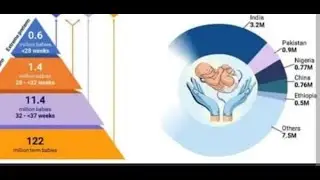 Evidence-based update on Preterm Labour: New Insights and Strategies by Prof. Dilly Anumba