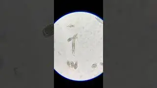Rotifer
