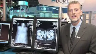Dome by NDSsi at RSNA 2010: The Right Choice