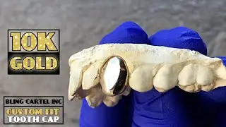 10K Solid Gold Cap Custom Fitted Single Tooth Grills (Choose Any Tooth Position)