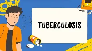 Tuberculosis