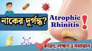 নাকের দুর্গন্ধ ও শুষ্ক খোসা &ndash; Atrophic Rhinitis কি? কারণ, লক্ষণ ও চিকিৎসা