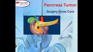 Dr. Muhammad Zakria. Consultant Hepatobiliary Surgeon. Surgery Cures Pancreas Tumor.