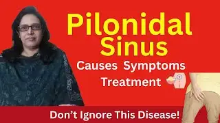 Pilonidal Sinus Treatment | Causes, Symptoms & Latest Surgery Explained by Prof  Dr  Amna Javed