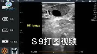 128 Elements Waterproof Dustproof Cow Fetal Disease Wireless USB Ultrasound Scanner Veterinary