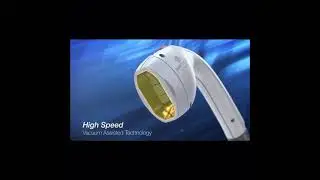 Luminis lightsheer desire epilasyon