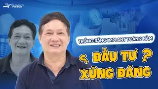 Trồng Răng Implant Toàn Hàm Có Đau Không? I Thực Tế Trồng Răng Implant Toàn Hàm Của Khách Hàng