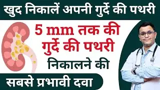Best homeopathic medicine for kidney stone- SBL clearstone drops या कोई और ?