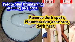 Remove dark spots, Pigmentation, acne scar, dark neck||POTATO Skin brightening & Glowing face pack