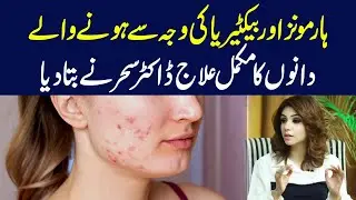 Clear Skin Ahead: Treating Hormonal and Bacterial Acne | Dr Sahar Chawla
