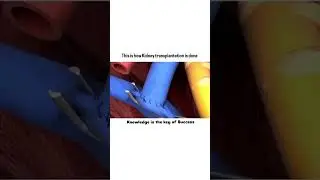#shorts #medicalknowledgeonline #kidneytransplantrecipient #surgerysuccess #motivation #kidney