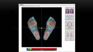 Valutazione Posturale BioPostural System - Pedana baropodometrica, Pedana stabilometrica