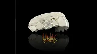UNIK GRILLZ -  Custom Grillz Double Caps with Moissanite Honeycomb Openface