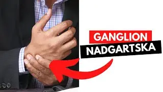GANGLION - GANGLION NADGARSTKA - TOP 3 INFORMACJE !