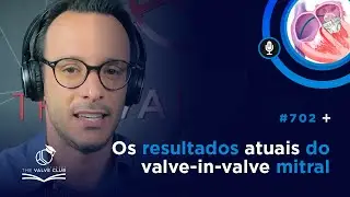 Click Valvar Academy #702 - Os resultados atuais do valve-in-valve mitral