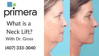 What is a Neck Lift? | Edward J. Gross, M.D.