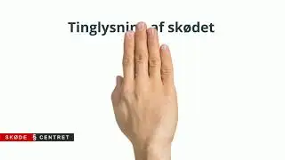 Sk&oslash;de mellem for&aelig;ldre og barn