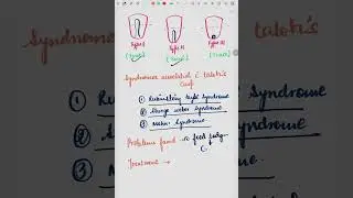 TALON'S CUSP || CLASSIFICATION AND PICTURES || DENTAL TALKS