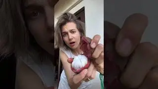 Queen Of Fruits - Mangosteen - Tastiest Fruit #shorts