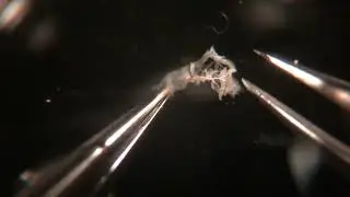 Lutz Kockel L3 Brain Dissection