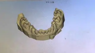 ONEDAY DENTISTRY - The digital process of making clear aligners using the 3D printer