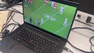 🔍 Patrick Mahomes vs. Vic Fangio: 8-0 Lifetime! 🏈🔥 #BaldysBreakdowns