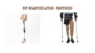 Artificial limbs